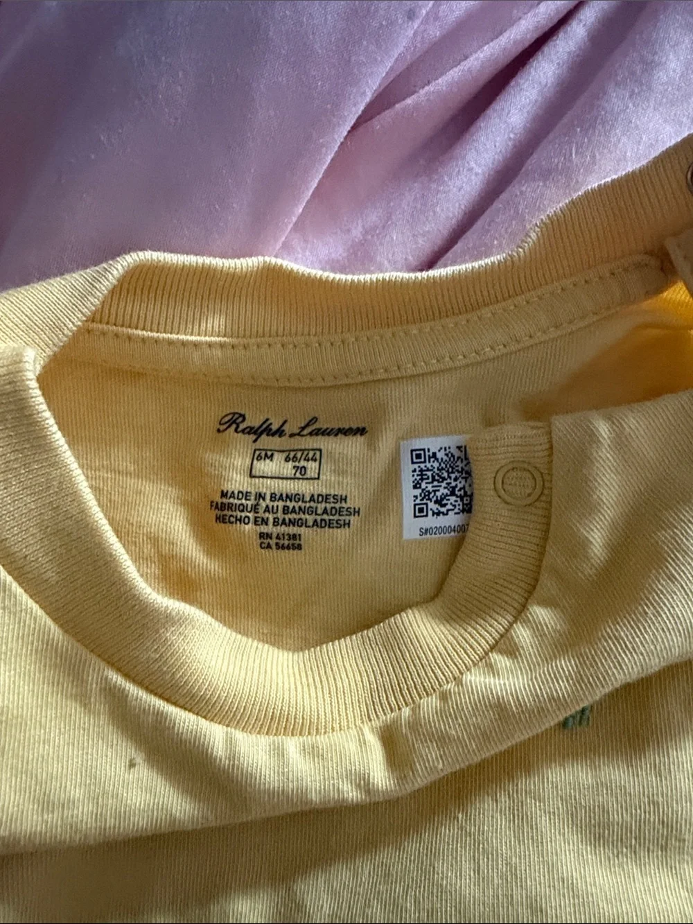 Yellow Baby Tee and Blue Kids Shorts Polo Set